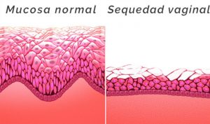 Tratamiento sequedad vaginal en Málaga