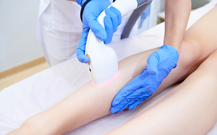 Depilación Láser Málaga