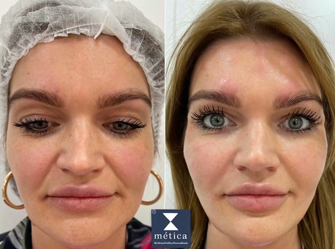 Tratamientos Faciales en Málaga